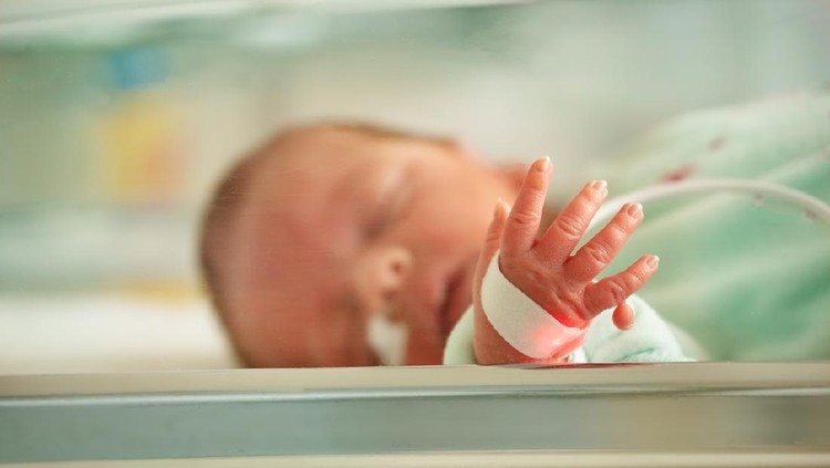 bayi sakit Close up of Supernumerary finger, Polydactyly case of newborn, a congenital physical anomaly, cosmetic defect