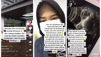 Viral Gara-gara Kisah 10 Bulan Telat Haid, Ini Fakta-fakta Penting PCOS