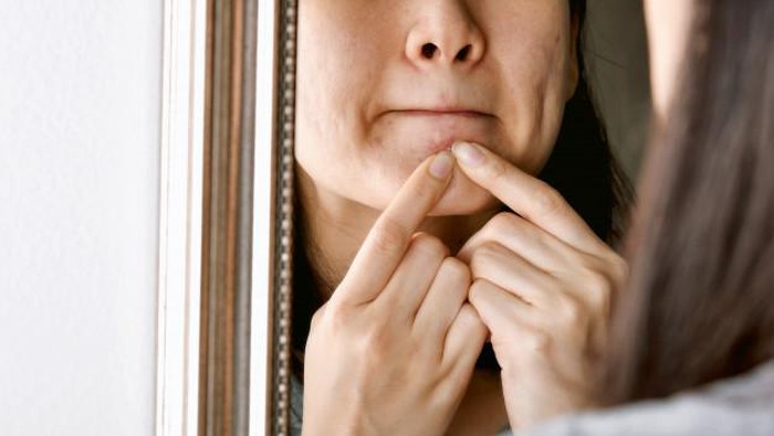 7 Cara Sederhana Atasi Maskne, Jerawat Bandel yang Muncul Saat Pakai Masker