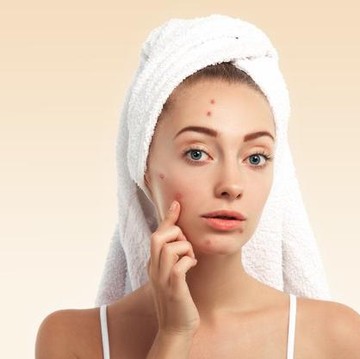 Fakta-Fakta Benzoyl Peroxide, Kandungan Skincare untuk Menghentikan Jerawat