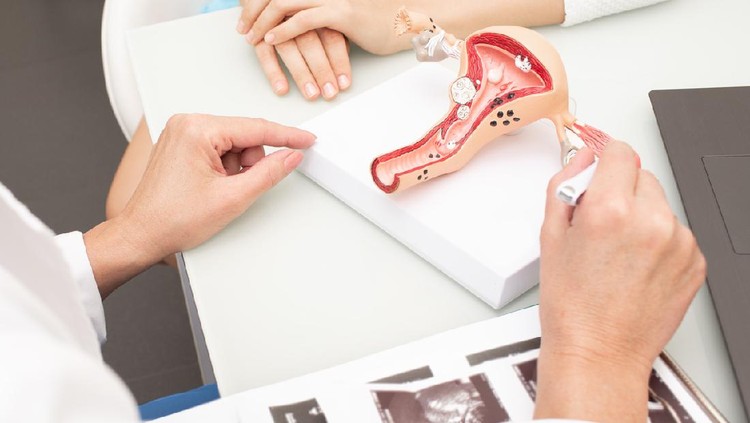Gynecology, women's health. Close-up of a uterus model