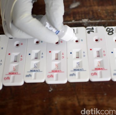 Prediksi Terbaru Akhir Pandemi COVID-19