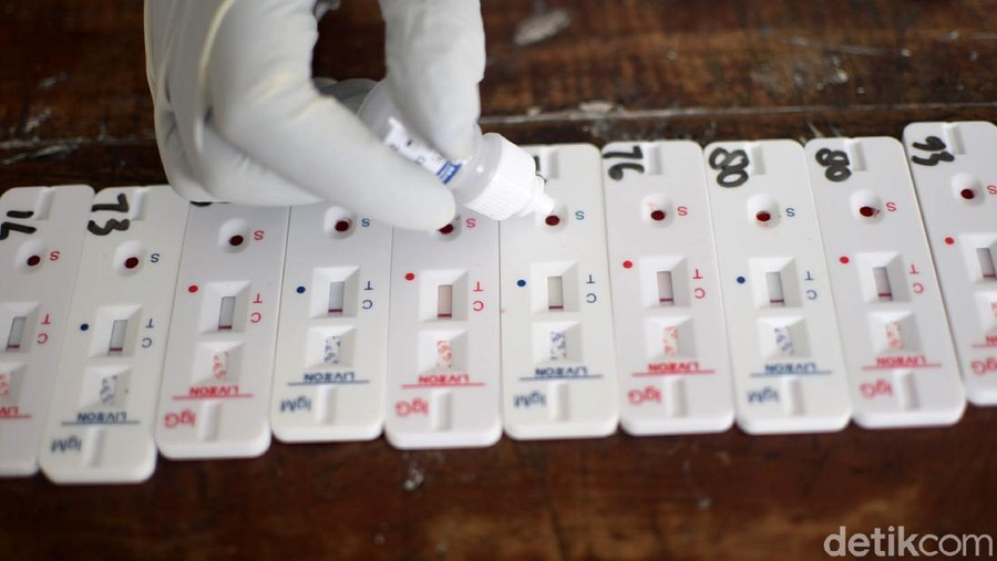 Rapid Test COVID-19 Digelar di Petamburan, 5 Orang Reaktif Corona Rapid test digelar di Petamburan menyusul terjadinya keramaian di kawasan itu usai kepulangan Habib Rizieq. Dari 276 warga yang dites, 5 orang reaktif Corona.