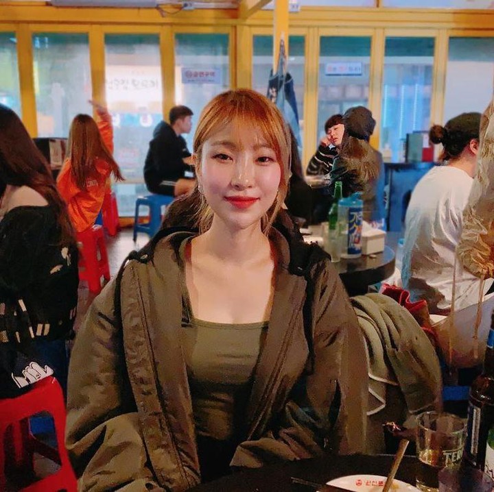 <p>Lee Se Young menjalani operasi plastik hingga kita benar-benar tidak menyadari kalau ia adalah pemeran Wang Ja Hyun Reply 1988. (Foto: Instagram @seyoung_1408)</p>