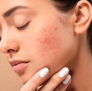 Jangan Lakukan! DIY Ini Bisa Merusak Wajah Kamu