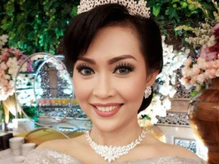 Ratna Listy Oplas Hidung & Sedot Lemak agar Terlihat Seperti Gadis Lagi