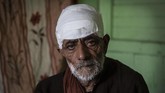 FOTO: Serangan Binatang Buas di Kashmir Serangan binatang buas telah memakan korban jiwa puluhan orang di Kashmir.