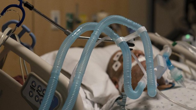 Rasa sakit masih terbayang dalam benak penyintas Covid-19 kala menjalani hari-hari perawatan menggunakan ventilator.