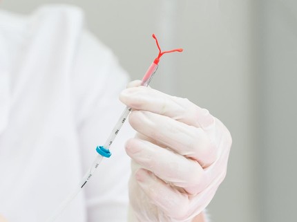 3 Penyebab KB IUD Tiba-tiba Hilang, Waktu Pemasangan Berpengaruh Bun