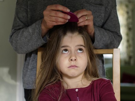 5 Penyebab Rambut Anak Mudah Rontok, Kecemasan hingga Kudis Bun