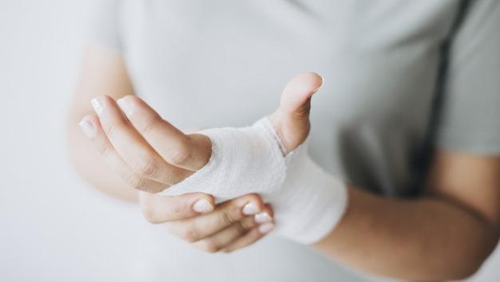 5 Rekomendasi Obat Luka Bakar 2020