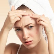 Sering Memencet Jerawat? Hentikan Kebiasaan Itu dengan Cara Berikut