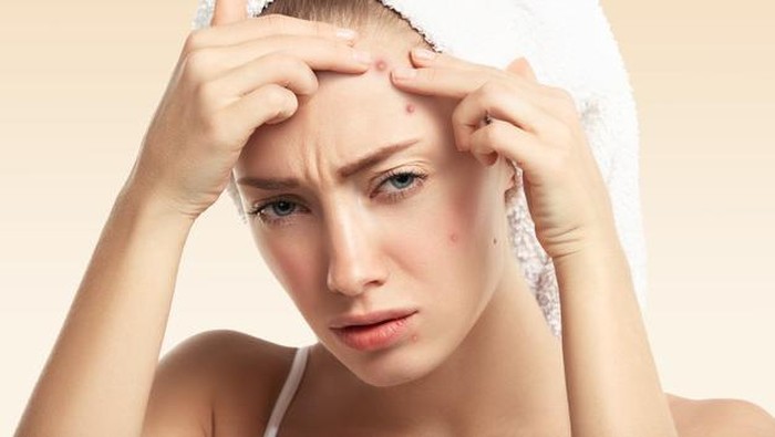 Sering Memencet Jerawat? Hentikan Kebiasaan Itu dengan Cara Berikut Sering Memencet Jerawat? Hentikan Kebiasaan Itu dengan Cara Berikut