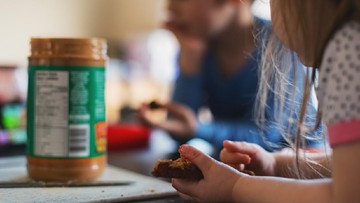 Fakta Tentang Alergi Kacang Pada Anak