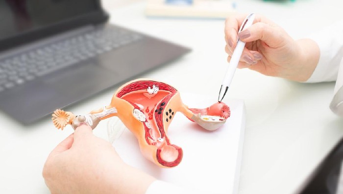 Gynecologist showing uterine structure on a uterus model. Uterus model on gynecologist's desk close-up