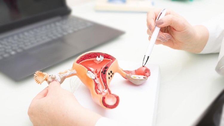 Gynecologist showing uterine structure on a uterus model. Uterus model on gynecologist's desk close-up