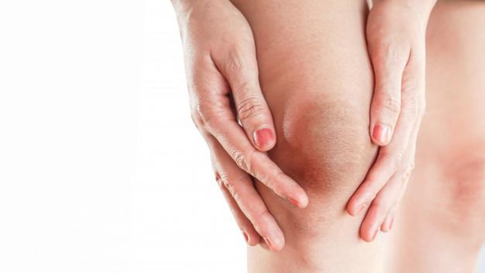 Lutut dan Siku Kamu Hitam? Gunakan Cara Ini untuk Memutihkannya!