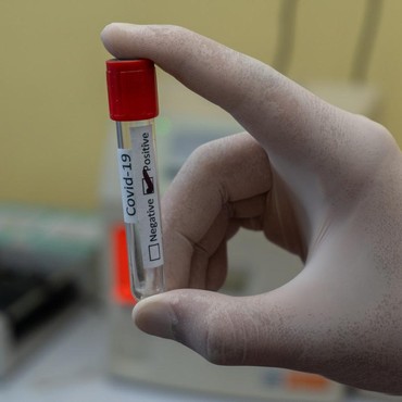 Dwi Sasono Hingga Asri Welas Jalani Vaksinasi Covid-19 Tahap Dua