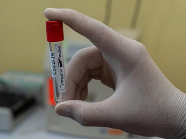 Ada Jenis Varian Baru 'Eek' Virus COVID-19, Apa Itu?