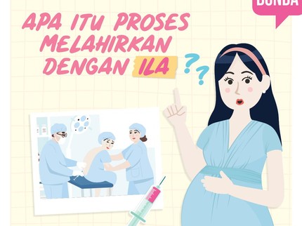 Apa Itu Proses Melahirkan dengan ILA