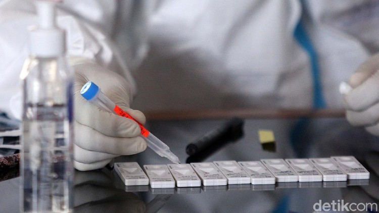 104 Warga Jalani Rapid Test Swab Antigen



Warga mengikuti tes swab rapid tes antigen di Walikota Jakarta Timur, Jakarta, Rabu (16/12/2020). Sebanyak 104 warga menjalani rapid tes swab antigen. hw