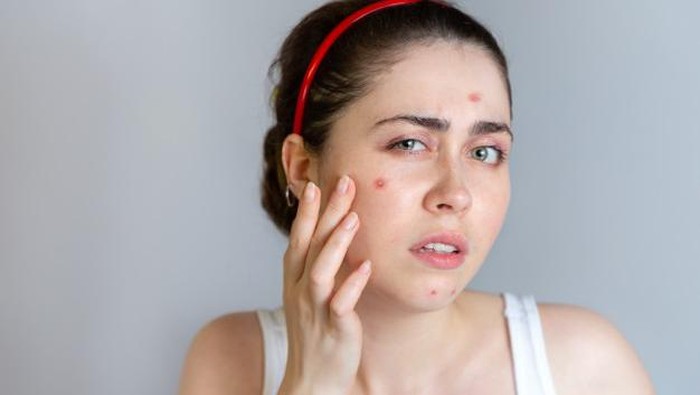 WFH Jadi Gampang Jerawatan? Cobain Rangkaian ERHA AcneAct Witch Hazel Series yuk, Ladies! WFH Jadi Gampang Jerawatan? Cobain Rangkaian ERHA AcneAct Witch Hazel Series yuk, Ladies!