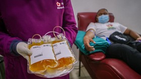 Terapi Plasma Belum Terbukti Efektif untuk Kasus Berat Covid