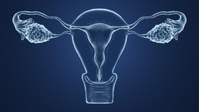 5 Penyebab Wanita Harus Histerektomi atau Pengangkatan Rahim