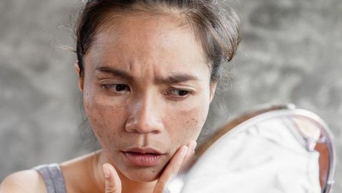 Biar Gak Rusak, 5 Hal Ini Sebaiknya Jangan Kamu Lakukan pada Kulitmu