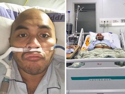 Kisah Viral 11 Hari di ICU, Kena COVID-19 Meski Rajin Olahraga