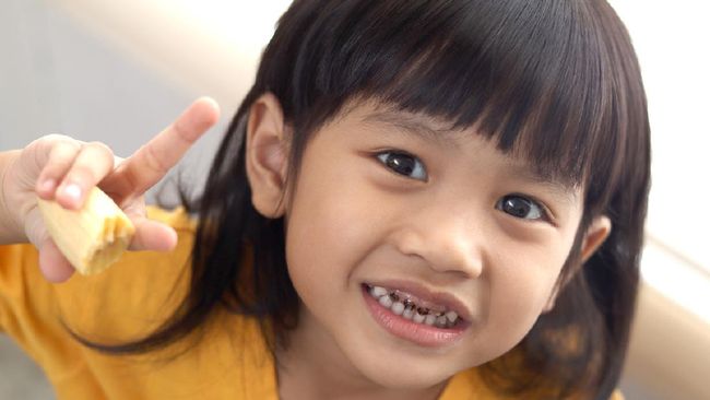 Kenali Ciri Gigi Anak Rusak Sebelum Berlubang dan Menghitam