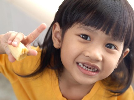 Kenali Ciri Gigi Anak Rusak Sebelum Berlubang dan Menghitam