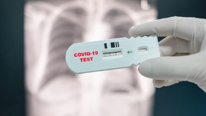 COVID-19 Rapid Test Kit with Samples and Pills.3d Render