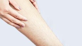Hirsutisme dan Cerita Perempuan dengan Bulu Lebat di Dada