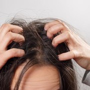 Ini Kesalahan yang Menyebabkan Rambut Kamu Jadi Kutuan!