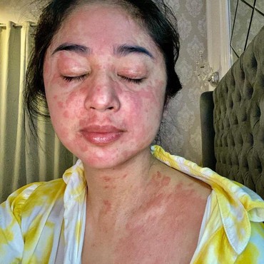 Positif Covid-19, Dewi Perssik Akui Bandel Terapkan Protokol Kesehatan