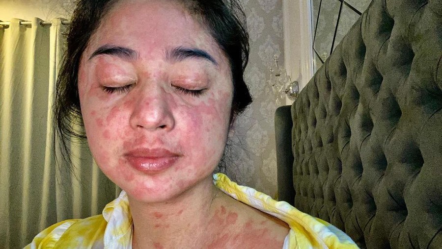 Manisnya Dewi Persik Saat Makan Strawberry dan Rayakan Ulang Tahun