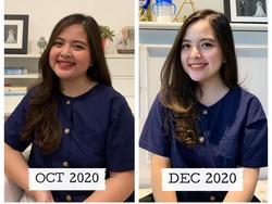 Berhasil Diet dan Bikin Pangling, Tasya Kamila Ingatkan Semua Wanita Cantik