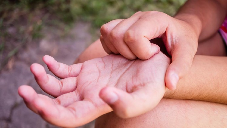 itchy palms, Children are itching palm, The child is scratching his hand due to itching, A child scratching his hand, The child is scratching his hand because he is itching.