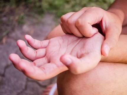 Telapak Tangan Gatal pada Anak, Kenali Pemicu dan Cara Mengatasinya
