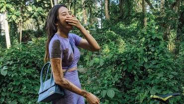 Anya Geraldine Trending Usai Jatuh dari Sepeda, Chef Arnold Tak Terima
