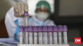 Dinkes: Bupati Sleman Positif Covid Tak Terkait Vaksin