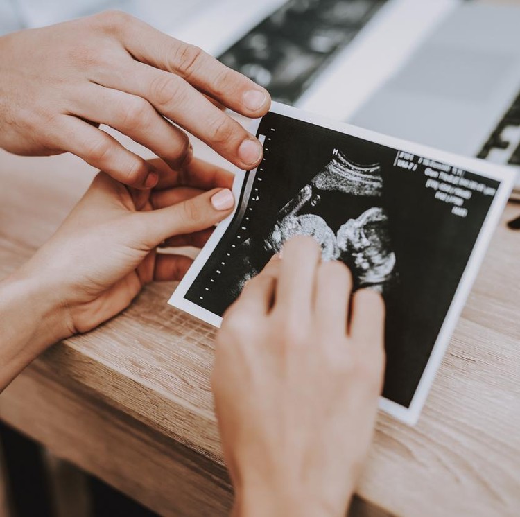 usg Picture. Ultrasound. Pregnant Girl. Motherhood. Doctor Show. Consultation. Gynecology. Hospital. Doctor. Clinic. Gynecologist. Medical Advice. Woman. White Coat. Have Fun. Childbirth. Belly. Fan.
