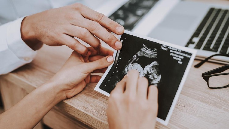 usg Picture. Ultrasound. Pregnant Girl. Motherhood. Doctor Show. Consultation. Gynecology. Hospital. Doctor. Clinic. Gynecologist. Medical Advice. Woman. White Coat. Have Fun. Childbirth. Belly. Fan.