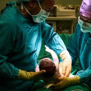 Moms Perlu Tahu, Ini Pantangan yang Harus Dihindari Setelah Operasi Caesar