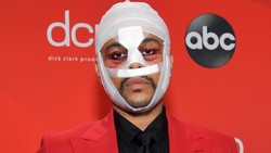 Diduga Lakukan Oplas, Wajah The Weeknd Disebut Mirip Squidward