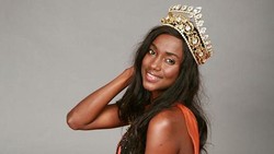 Wajah Ratu Kecantikan Hancur Jerawatan & Karier Terancam karena Skincare