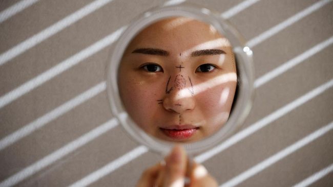 Aktris asal China, Gao Liu mengalami infeksi setelah operasi plastik yang membuat hidungnya menghitam dan membusuk.
