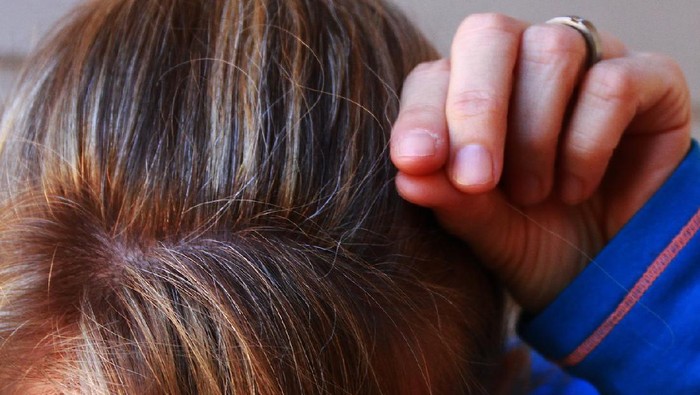 Jangan Heran Lagi, Ini Alasan Uban Bisa Muncul di Usia Dini