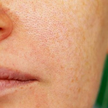 5 Rekomendasi Skincare untuk Mengecilkan Pori-Pori Wajah, Bikin Wajah Terlihat Mulus!